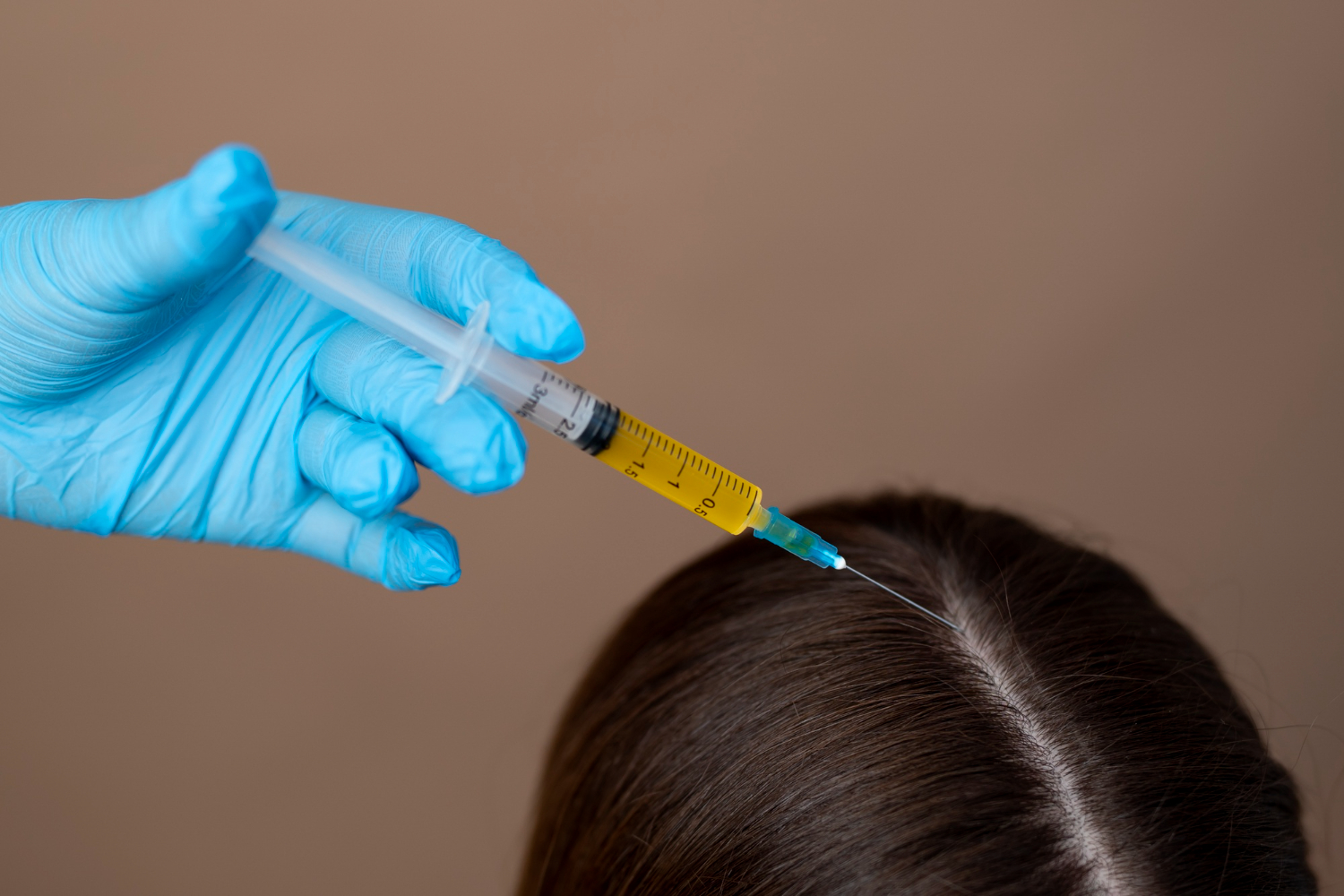 ACell Micromatrix treatment for hair loss in Riyadh