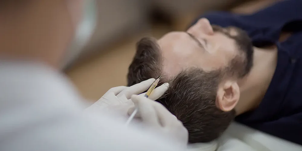 Injectable Dutasteride scalp treatment for androgenetic alopecia in Riyadh