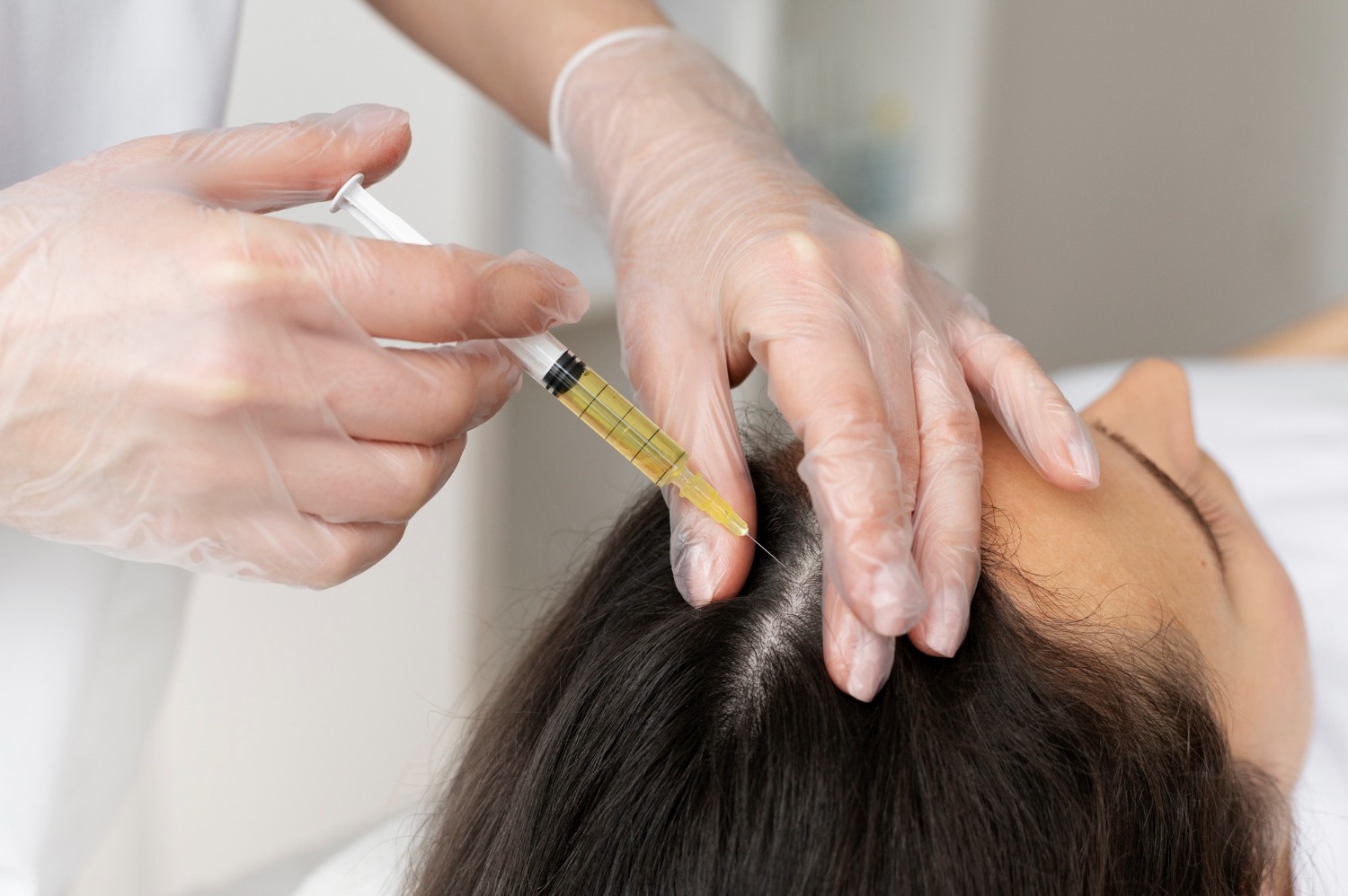 Patient receiving Magellan PRP hair restoration therapy in Riyadh