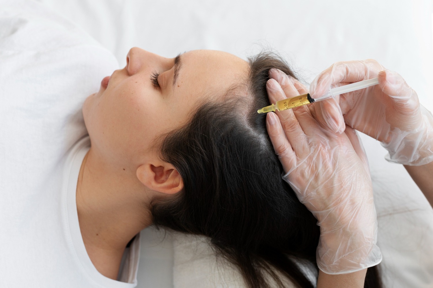 Patient receiving PRP hair treatment at Reveal Clinics in Riyadh