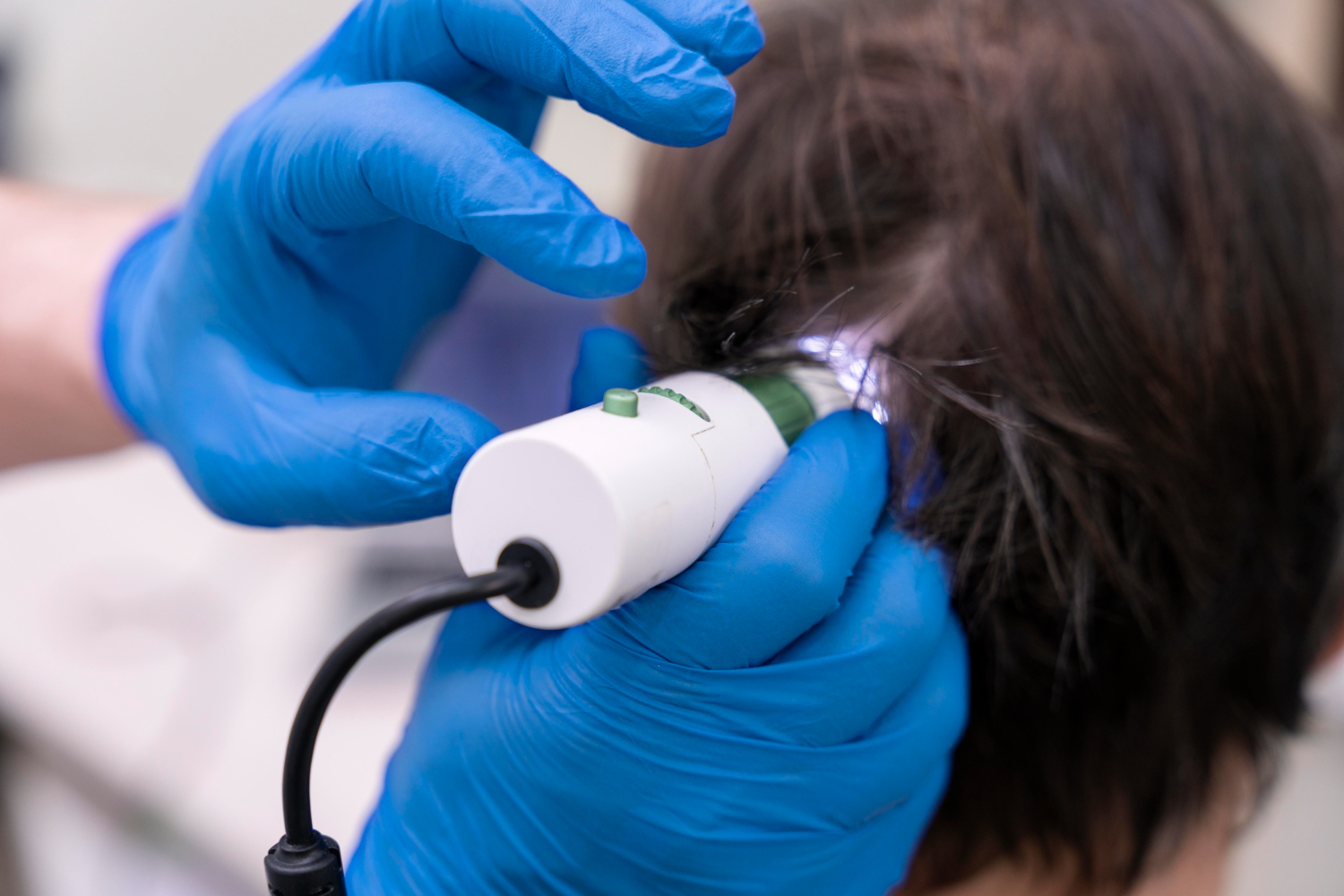 ResurFX laser therapy for hair loss in Riyadh clinic