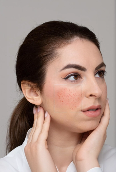 Pigmentation Before
