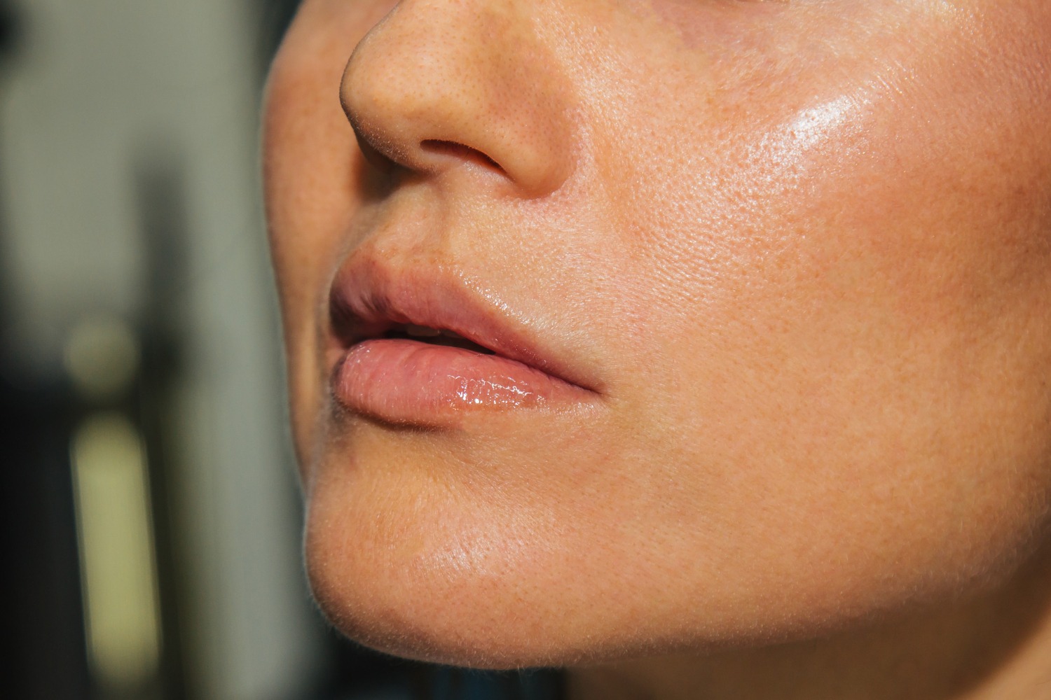 Natural glowing skin after hydration treatment