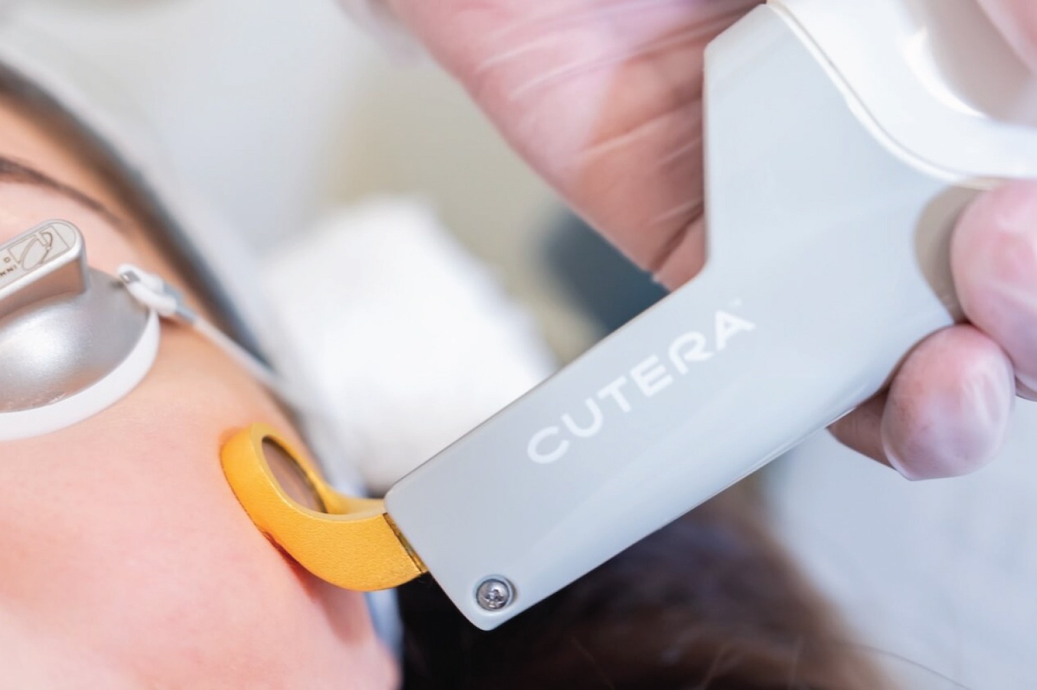 Excel V+ laser consultation with Dr. Haitham Al-Gzlan in Riyadh