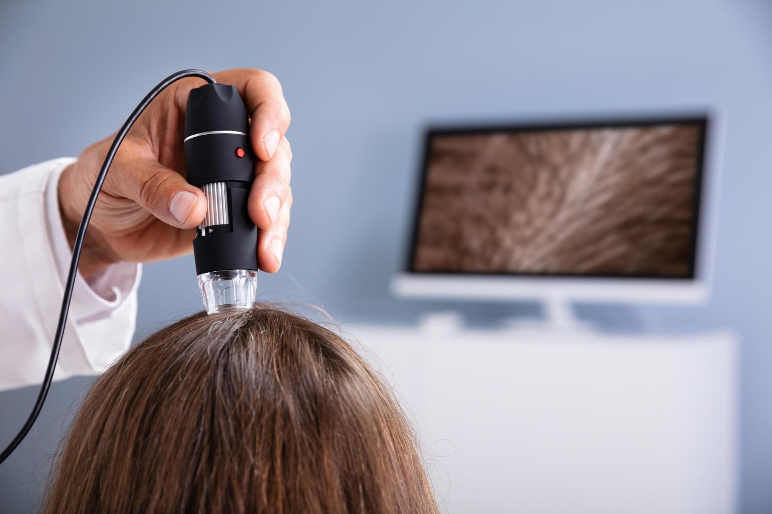 FotoFinder Vexia hair screening device in Riyadh