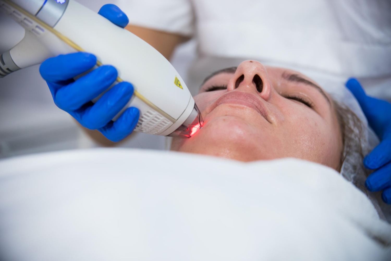 Fraxel fractional laser device used for skin resurfacing in Riyadh