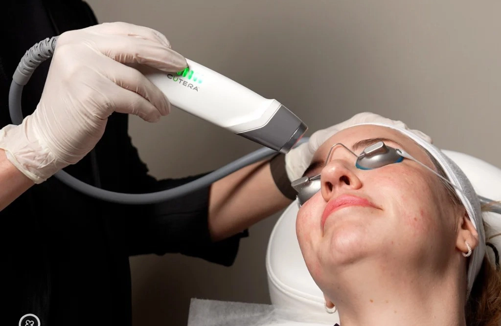 Laser Genesis treatment for acne-related redness and enlarged pores