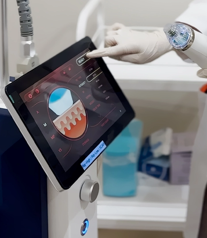 Secret RF microneedling for skin texture and rejuvenation
