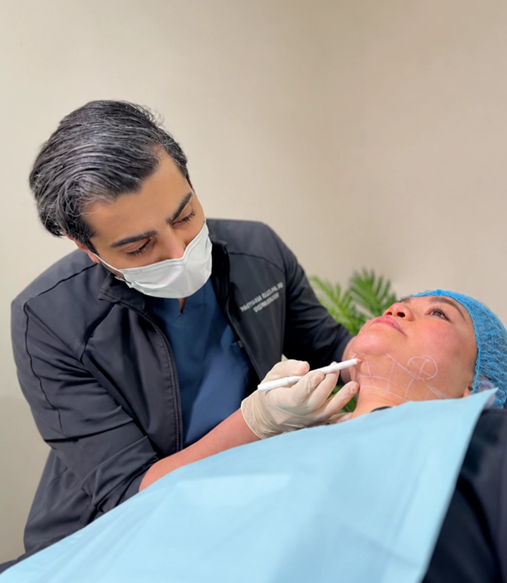 Secret RF treatment for fine lines, stretch marks and mild skin laxity