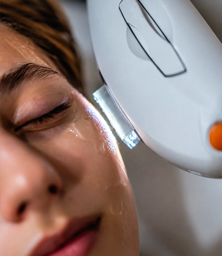 M22 IPL treatment for pigmentation, sun damage and uneven skin tone