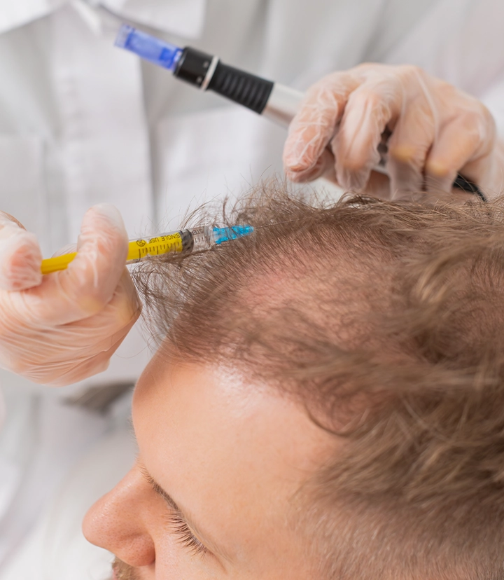 PRF treatment for hair thinning and hair loss