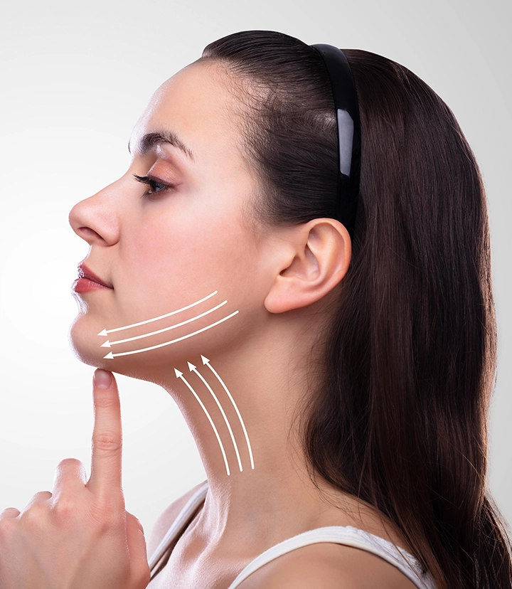 Secret RF microneedling for acne scars, pores and skin texture