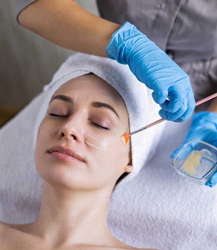 What chemical peel treatment can help with