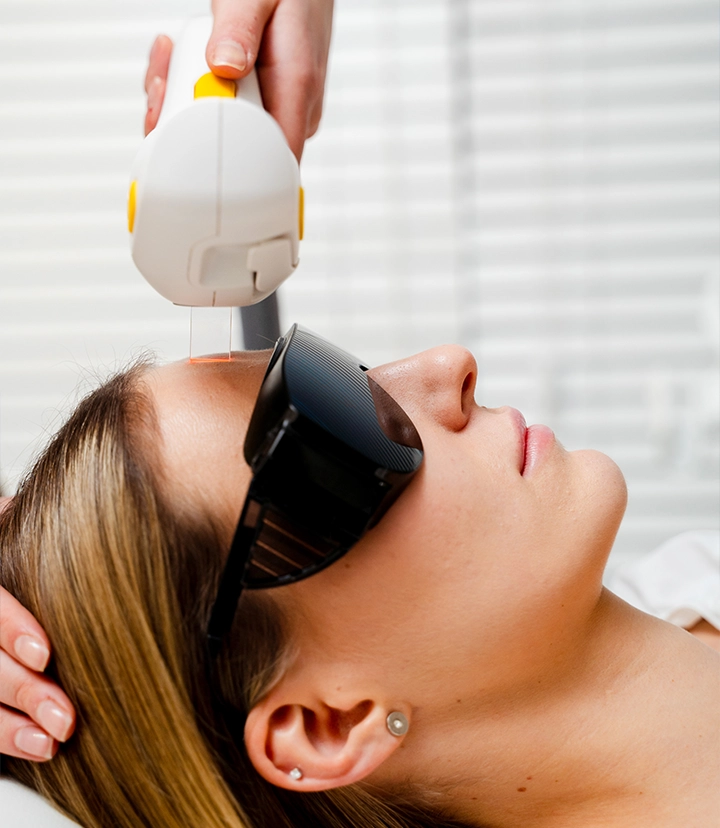 M22 IPL treatment for facial redness and visible broken capillaries