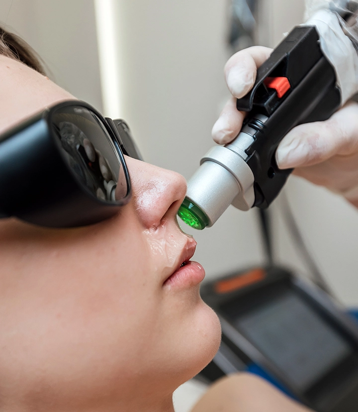 Fractional CO2 laser treatment for skin resurfacing by Dr. Haitham Al-Gzlan