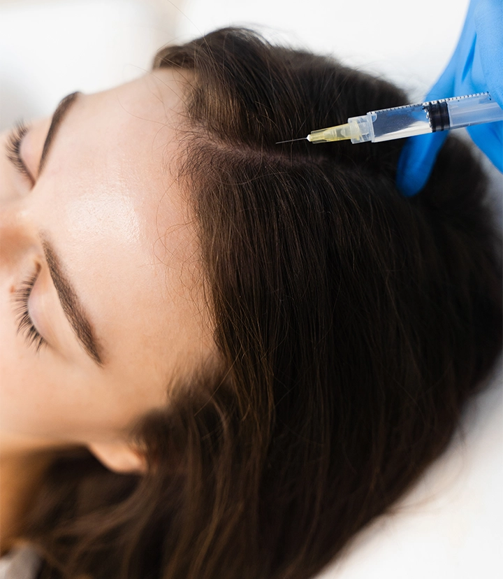 PRF hair restoration treatment by Dr. Haitham Al-Gzlan