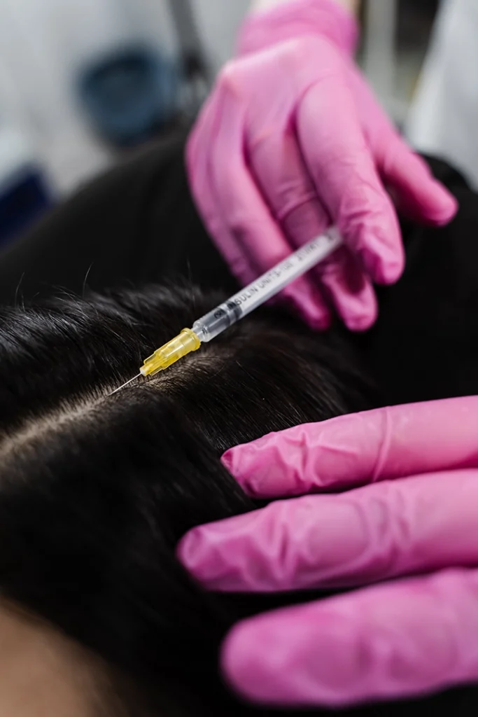 Personalized hair loss treatment in Riyadh