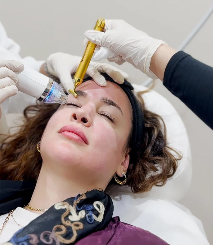 Secret RF Microneedling Treatment in Riyadh